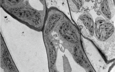Succeed your sample preparation in Microscopy