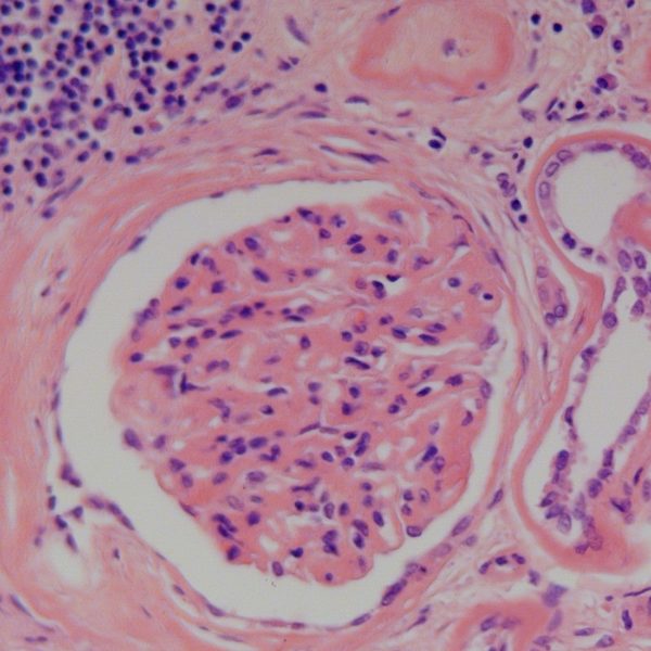 Harris' Hematoxylin