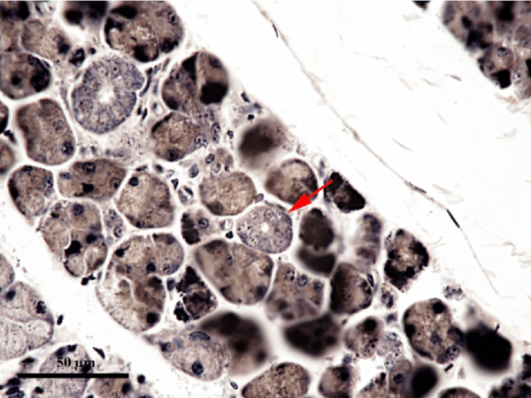 Hematoxylin Solution & Heidenhain’s Hematoxylin