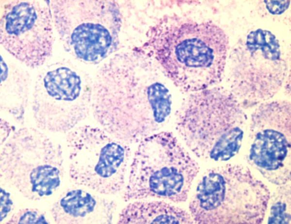 Ehrlich's Hematoxylin