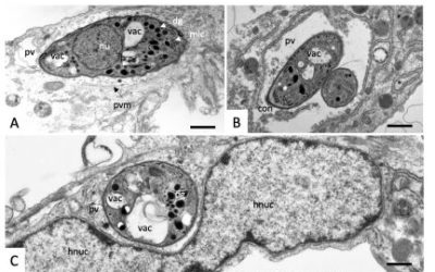 uranyless used  in EM stain  infection analysis  for Malaria and some parasites that affect humans and animals.